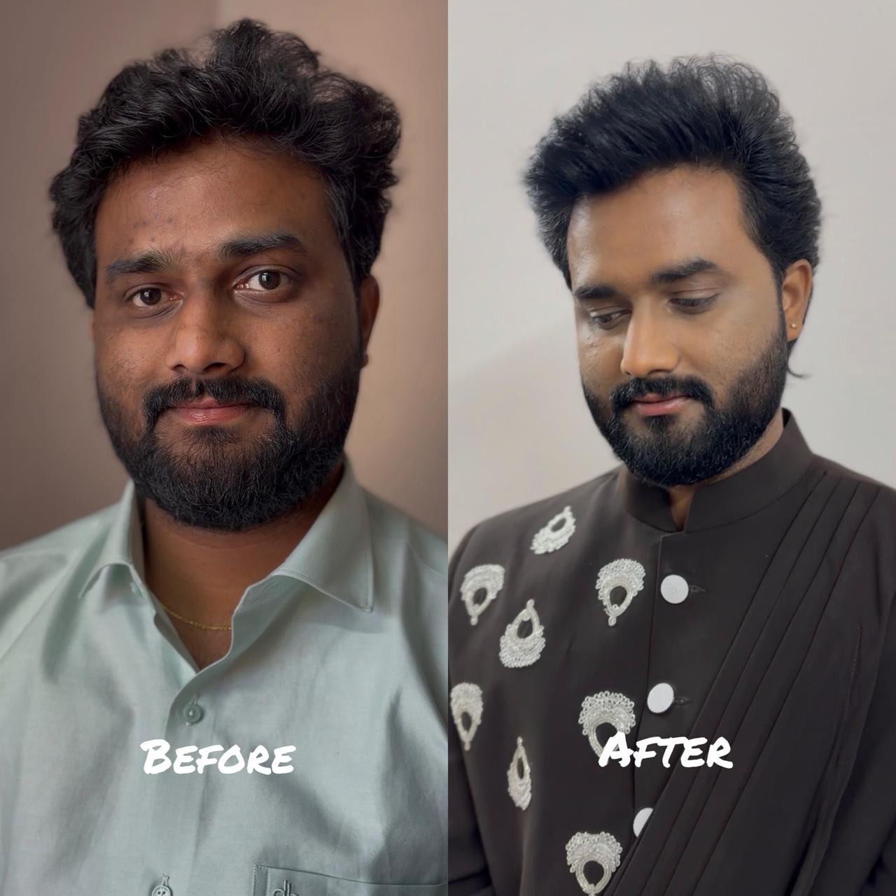 Groom Makeup Before After Chennai